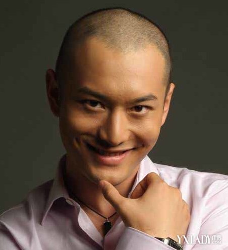 ??明星謝頂，坦然面對，重塑自信魅力??