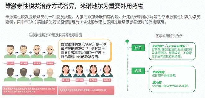 國際前沿脫發(fā)治療技術(shù)及其觀點(diǎn)論述